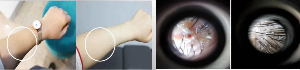 ba1