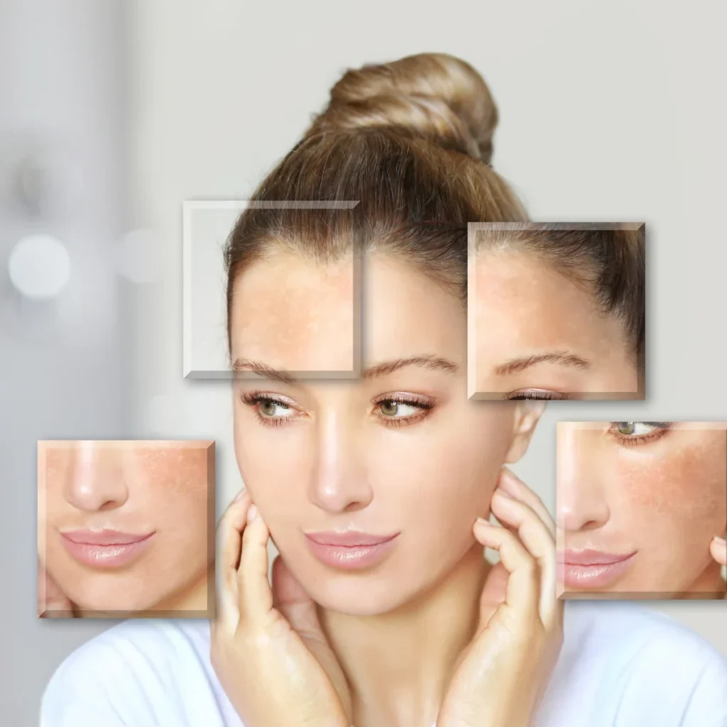 皮膚乾燥與屏障受損